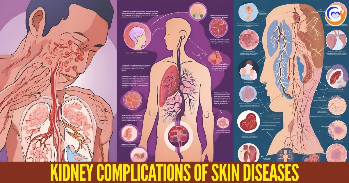 Kidney-Complications-of-Skin-Diseases