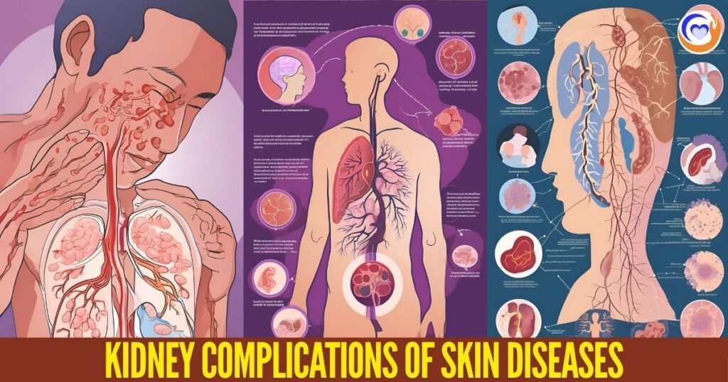 Kidney Complications of Skin Diseases