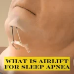 what is airlift for sleep apnea