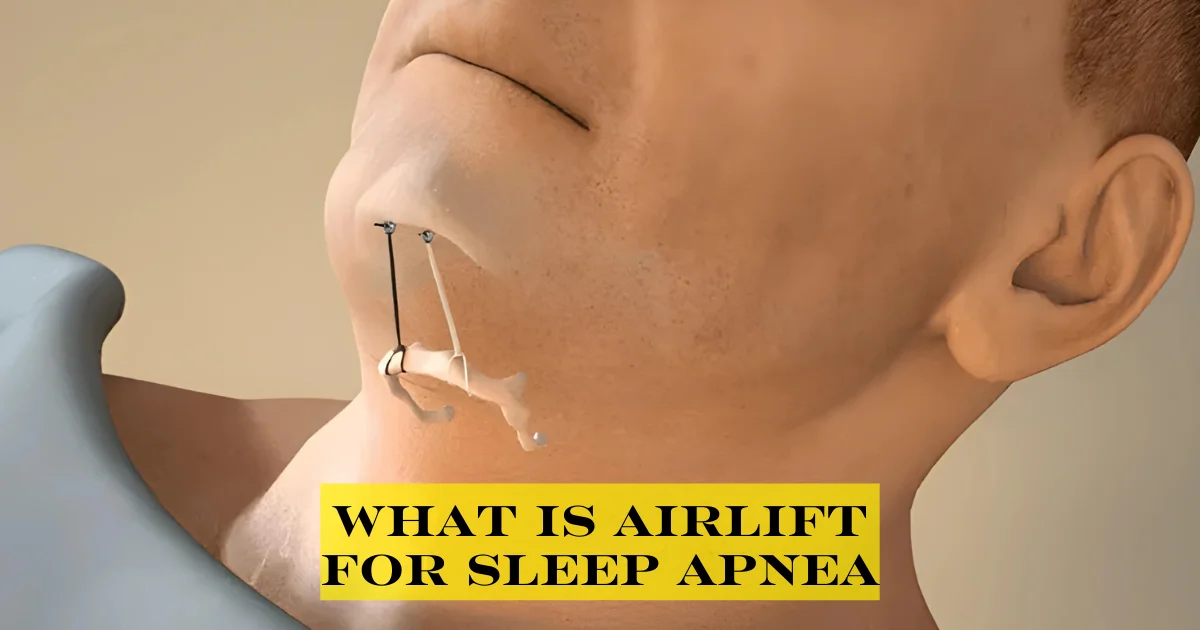 what is airlift for sleep apnea